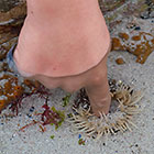 James' finger in sea anemone